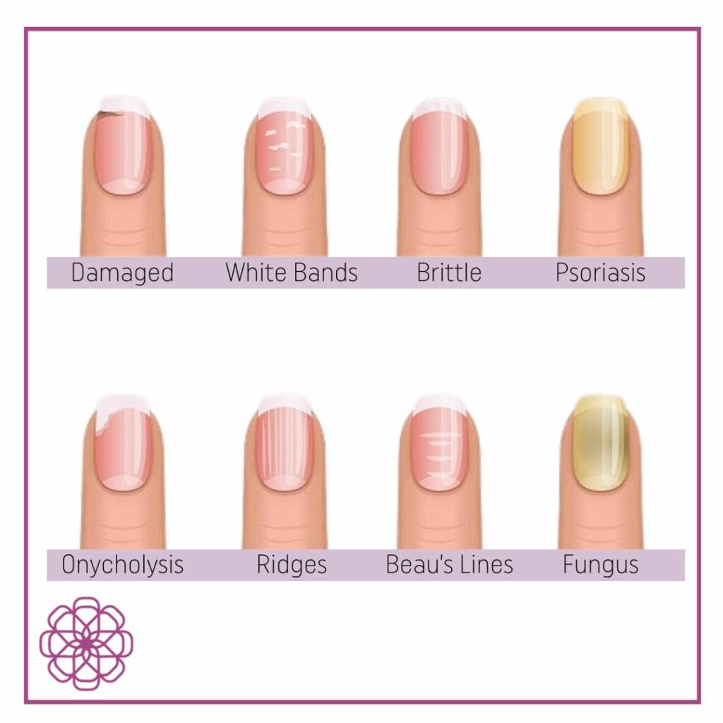 Common Nail Problems and Their Causes